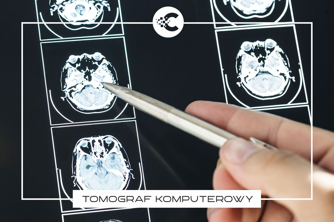 Na czym polega badanie tomografem komputerowym?