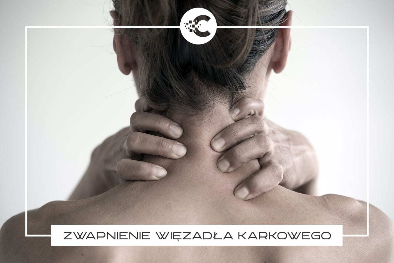 Zwapnienie w rzucie więzadła karkowego: Co to znaczy?