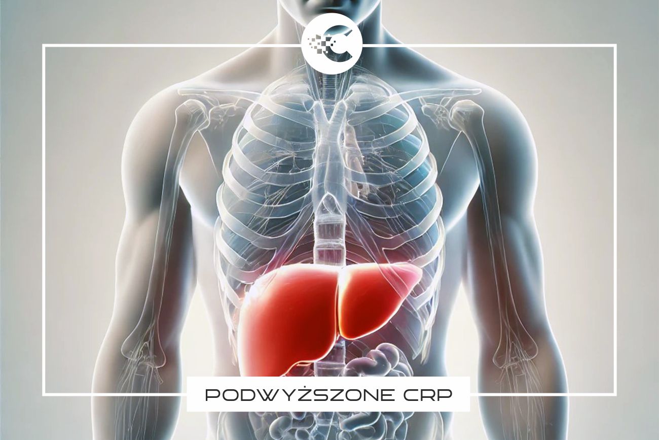 Co oznacza podwyższone CRP?