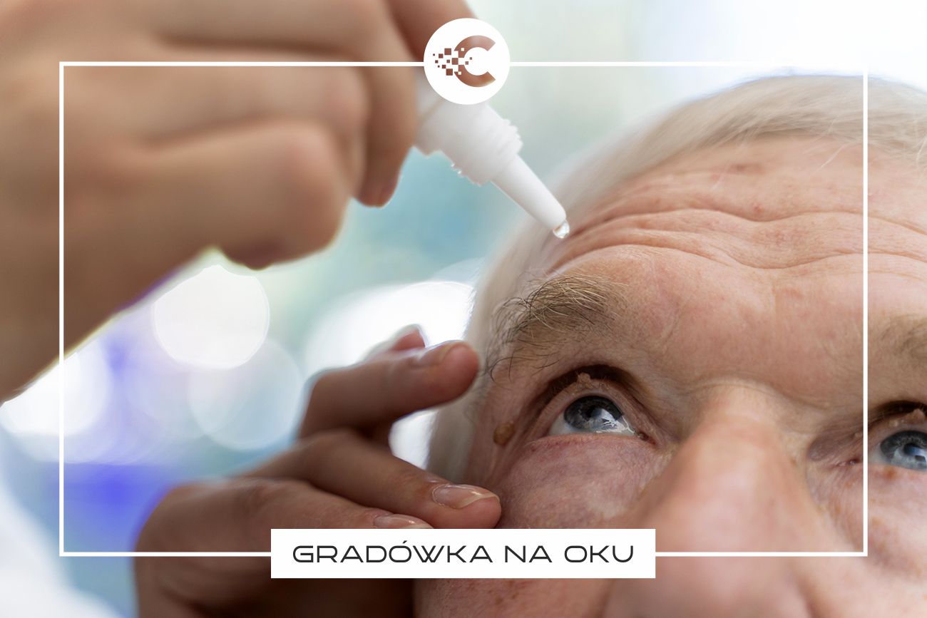 Gradówka: co to jest, przyczyny, objawy i leczenie.