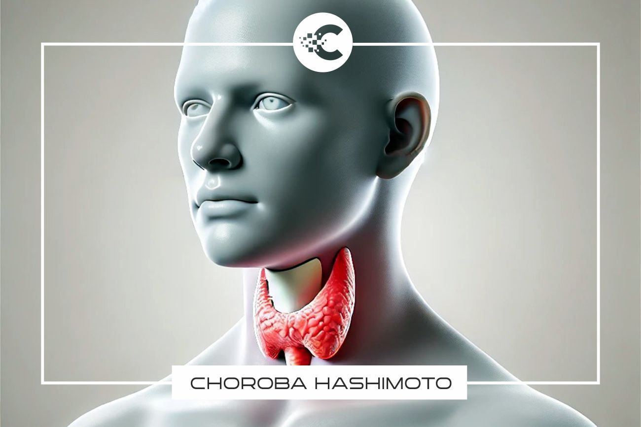 Czym jest choroba Hashimoto i jak ją rozpoznać?