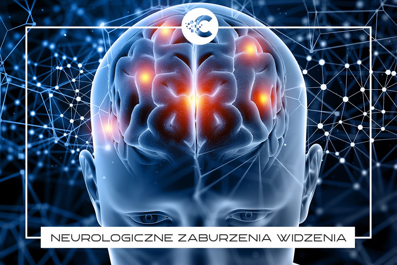 Neurologiczne zaburzenia widzenia.